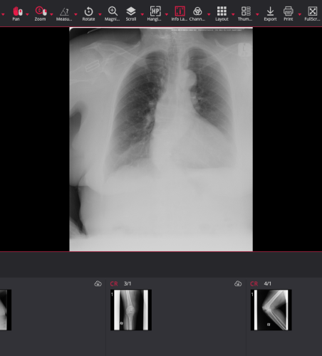 Confidential X-ray scan of chest lungs and leg along with patient details