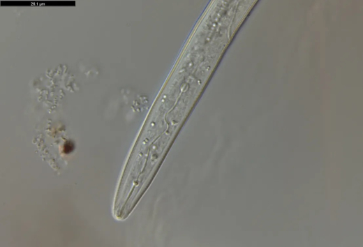 Meloidogyne chitwoodi (Photo: WUR)